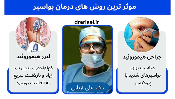 بهترین روش درمان بواسیر