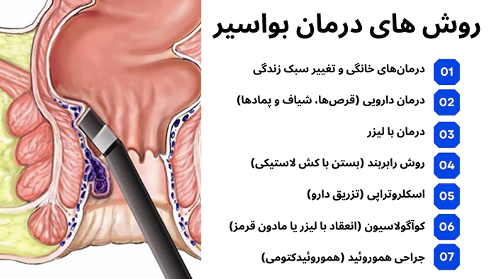 روش های درمان بواسیر