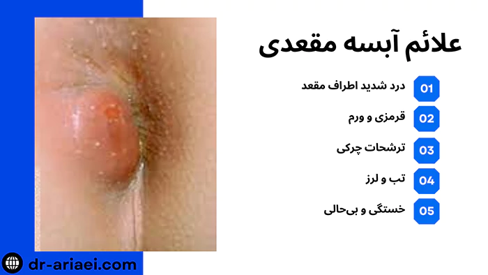 علائم آبسه مقعدی