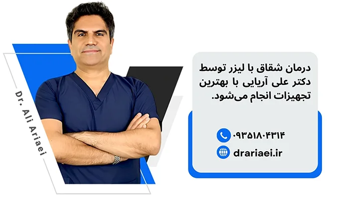 لیزر شقاق