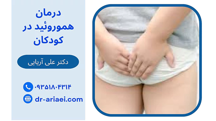 درمان هموروئید در کودکان