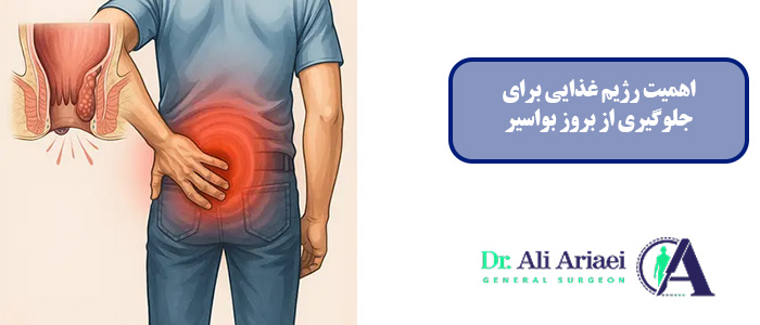 اهمیت رژیم غذایی برای جلوگیری از بروز بواسیر