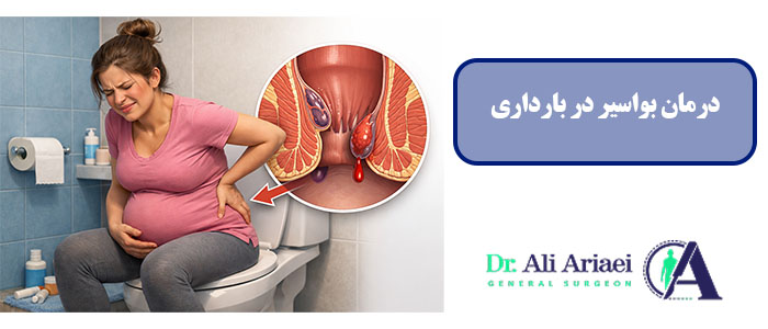 درمان بواسیر در بارداری